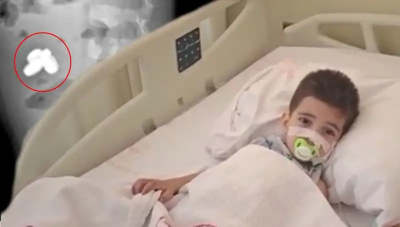 Küçük Çocuğun Pil ve Mıknatıs Yutması Hayati Tehlike Yarattı